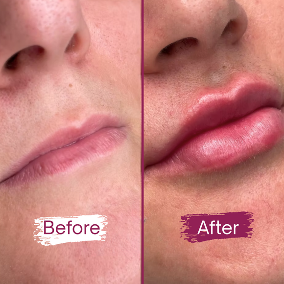 Feature product image